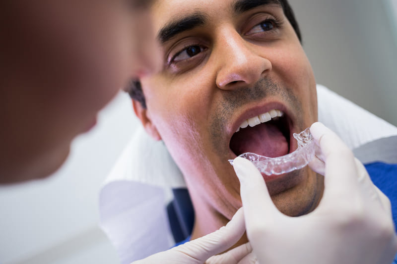 Invisalign para adultos, ¿Vale la pena después de los 30 años?