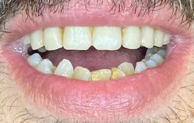Casos de tratamientos dentales en 1485 dental spa